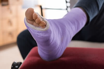 Foot Fractures treatment in the Port St Lucie, FL 34952, Stuart, FL 34994 and Hollywood, FL, 33021 areas