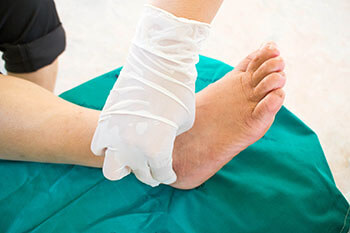 Diabetic Wound Care Diabetic Ulcers Treatment in the Port St Lucie, FL 34952, Stuart, FL 34994 and Hollywood, FL, 33021 areas